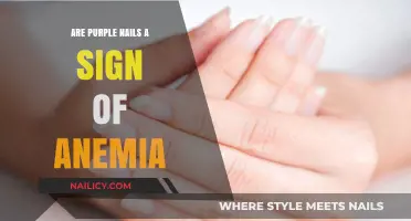 Purple Nails and Anemia: Uncovering the Hidden Health Connection