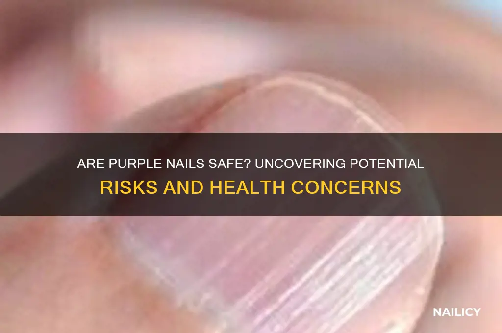 are purple nails dangerous