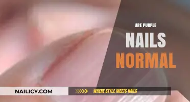Are Purple Nails Normal? Understanding Nail Health and Color Changes