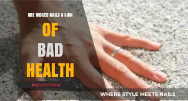 Ridged Nails: What They Reveal About Your Health