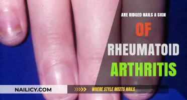 Ridged Nails and Rheumatoid Arthritis: Uncovering the Hidden Connection