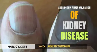 Unraveling the Mystery: Are Nail Ridges a Kidney Disease Indicator?