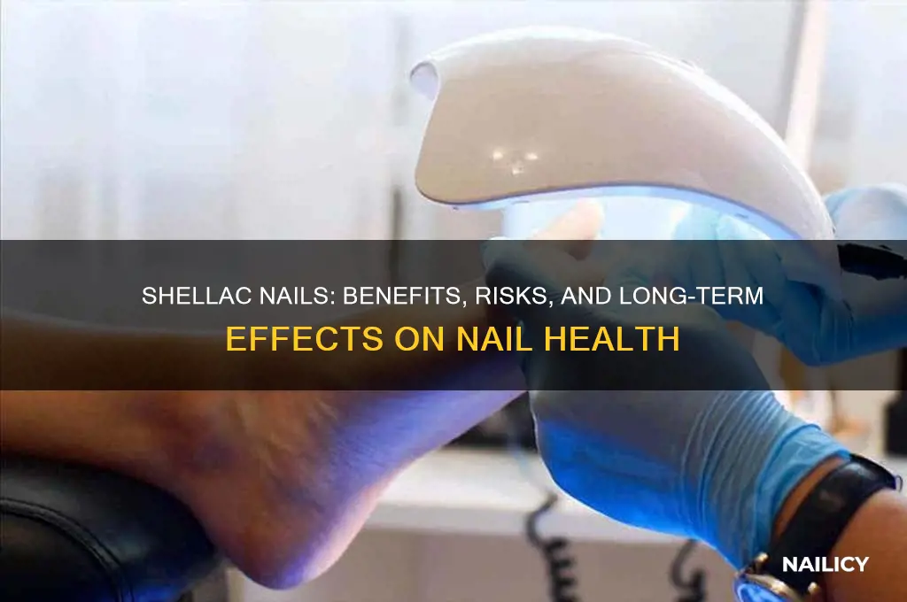 are shellac nails bad for your nails