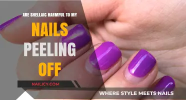 Shellac Nail Damage: Causes of Peeling and How to Prevent It