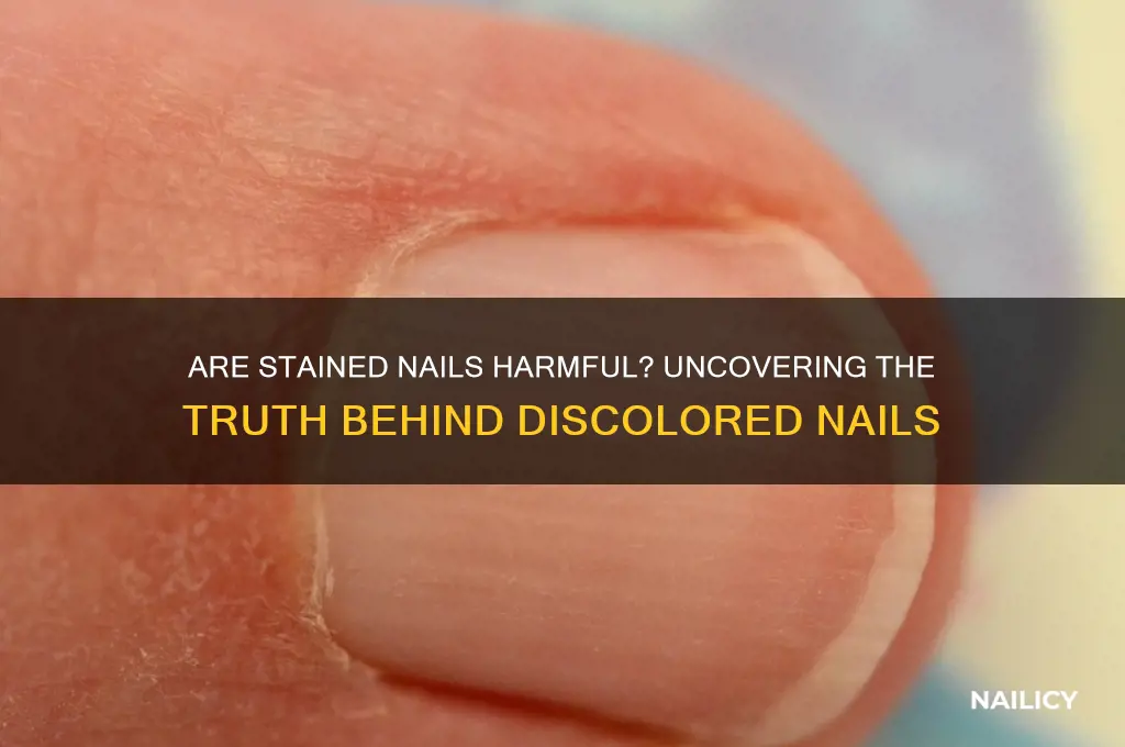 are stained nails bad