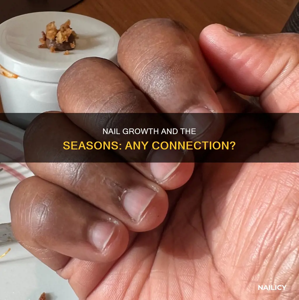 are there seasons where your nails grow faster