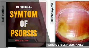 Thick Nails and Psoriasis: Uncovering the Surprising Connection and Symptoms