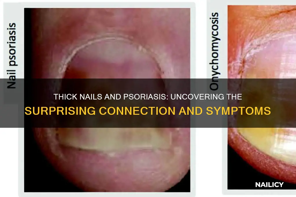 are thick nails a symtom of psorsis