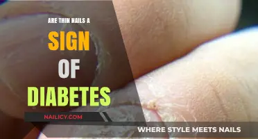 Thin Nails and Diabetes: Uncovering the Surprising Connection