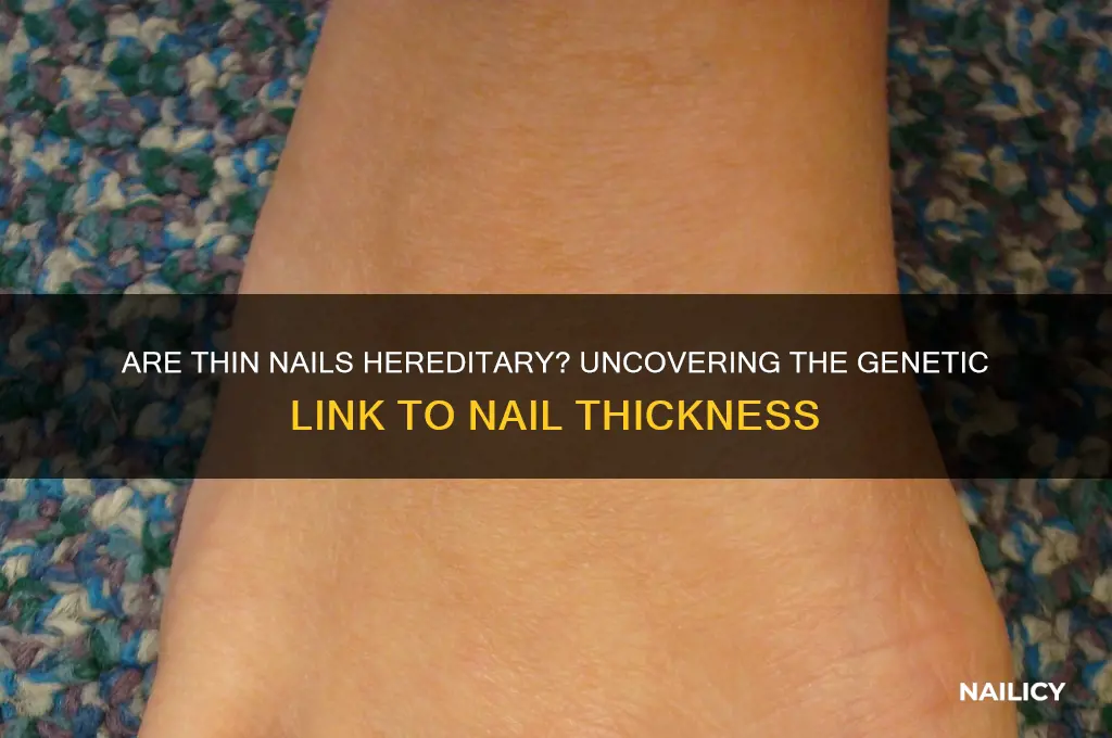 are thin nails hereditary