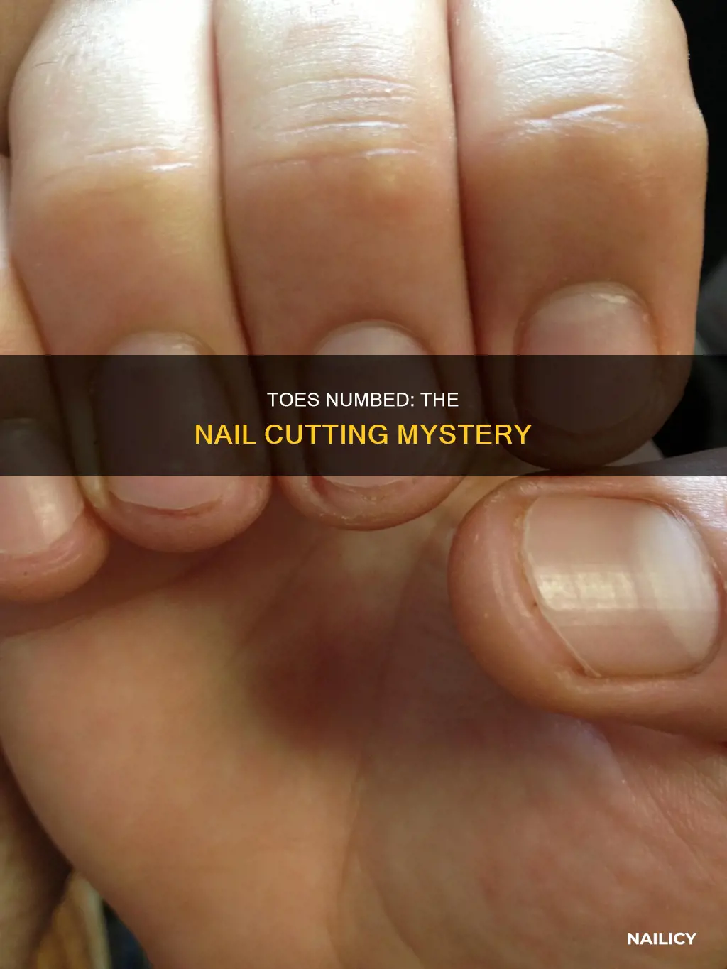 are toes numbed in nail cutting