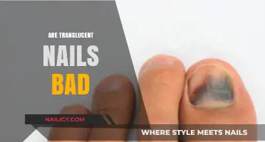 Are Translucent Nails a Sign of Poor Health? Find Out