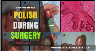 Nail Polish and Surgery: What’s Allowed in the Operating Room?