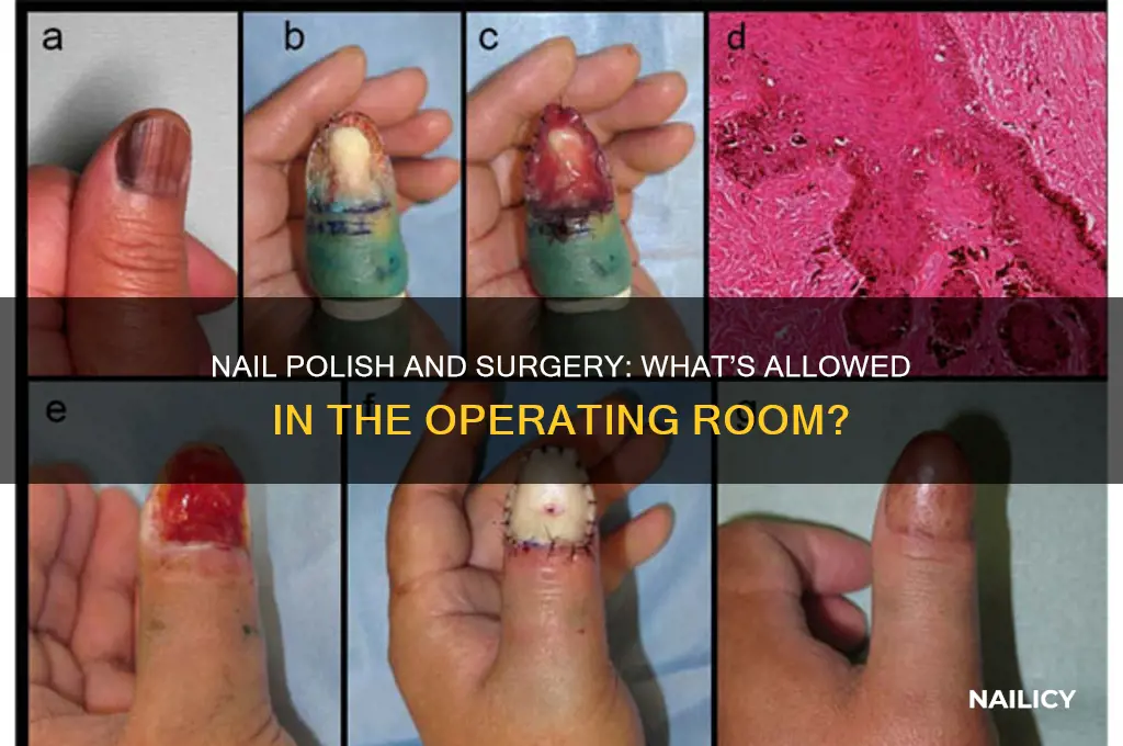 are u allowed nail polish during surgery