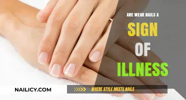 Weak Nails: A Silent Indicator of Underlying Health Issues?
