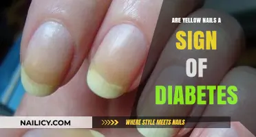Yellow Nails and Diabetes: Uncovering the Surprising Connection