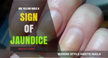 Yellow Nails and Jaundice: Uncovering the Hidden Connection