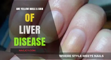 Yellow Nails and Liver Health: Uncovering the Hidden Connection