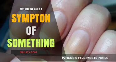 Yellow Nails: A Sign of Underlying Health Issues?