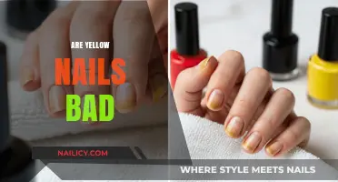 Yellow Nails: Causes, Concerns, and When to Seek Help