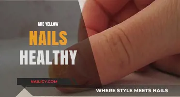 Yellow Nails: A Sign of Health or Hidden Concerns?