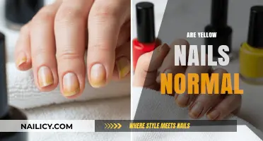 Are Yellow Nails Normal? Causes, Concerns, and When to Seek Help
