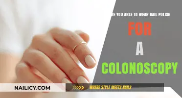Colonoscopy Prep: Can You Wear Nail Polish During the Procedure?