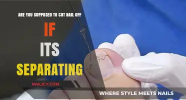 How to Treat and Trim Separating Nails