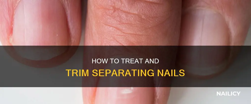 are you supposed to cut nail off if its separating