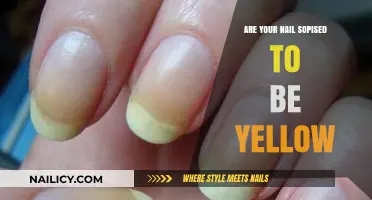 Why Are My Nails Yellow? Causes, Concerns, and Solutions Explained