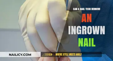Ingrown Nails: Can Nail Techs Help?