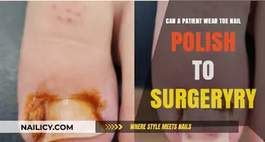 Can Patients Wear Toenail Polish During Surgery? Expert Insights