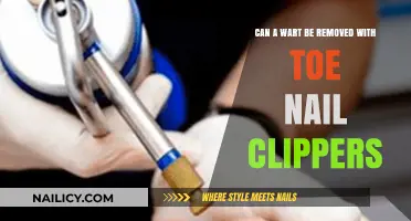 Toe Nail Clippers for Wart Removal: Safe or Not?
