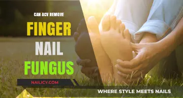 Apple Cider Vinegar: A Natural Remedy for Nail Fungus