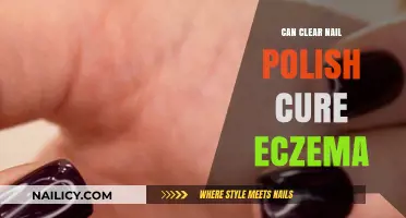 Can Clear Nail Polish Soothe Eczema Symptoms? Exploring the Myth