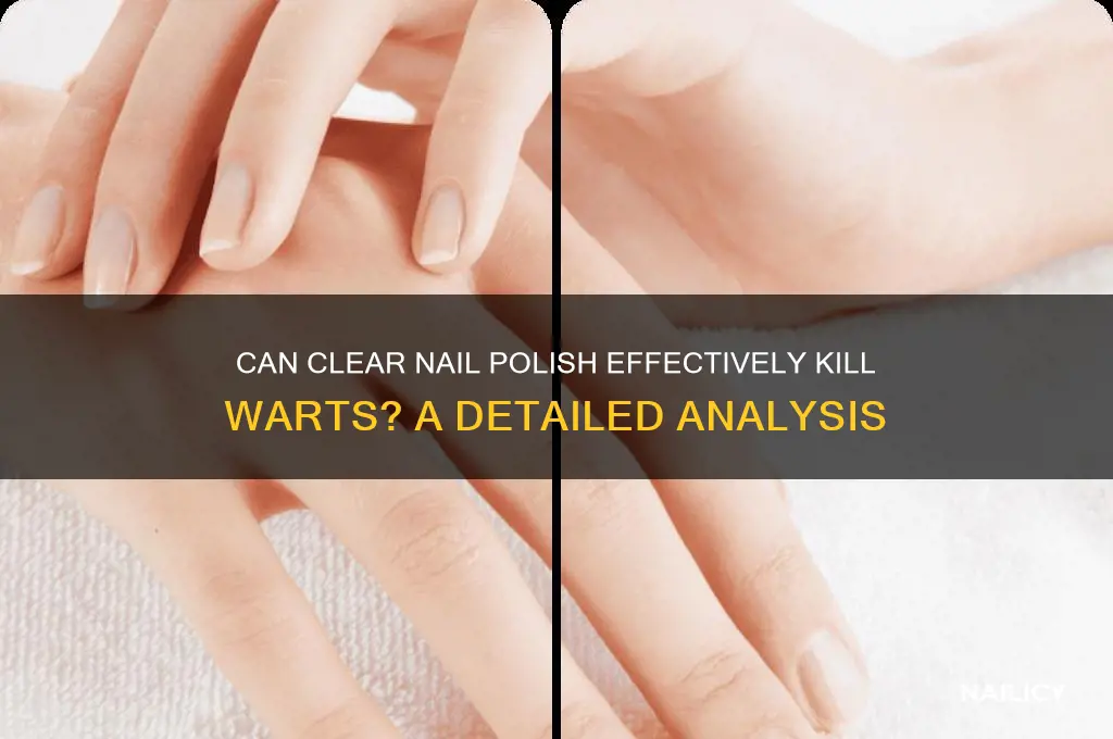can clear nail polish kill warts