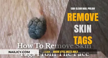 Clear Nail Polish: An Easy Solution for Skin Tags