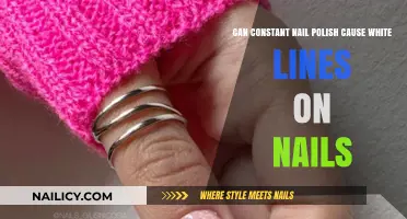 Does Constant Nail Polish Use Lead to White Lines on Nails?