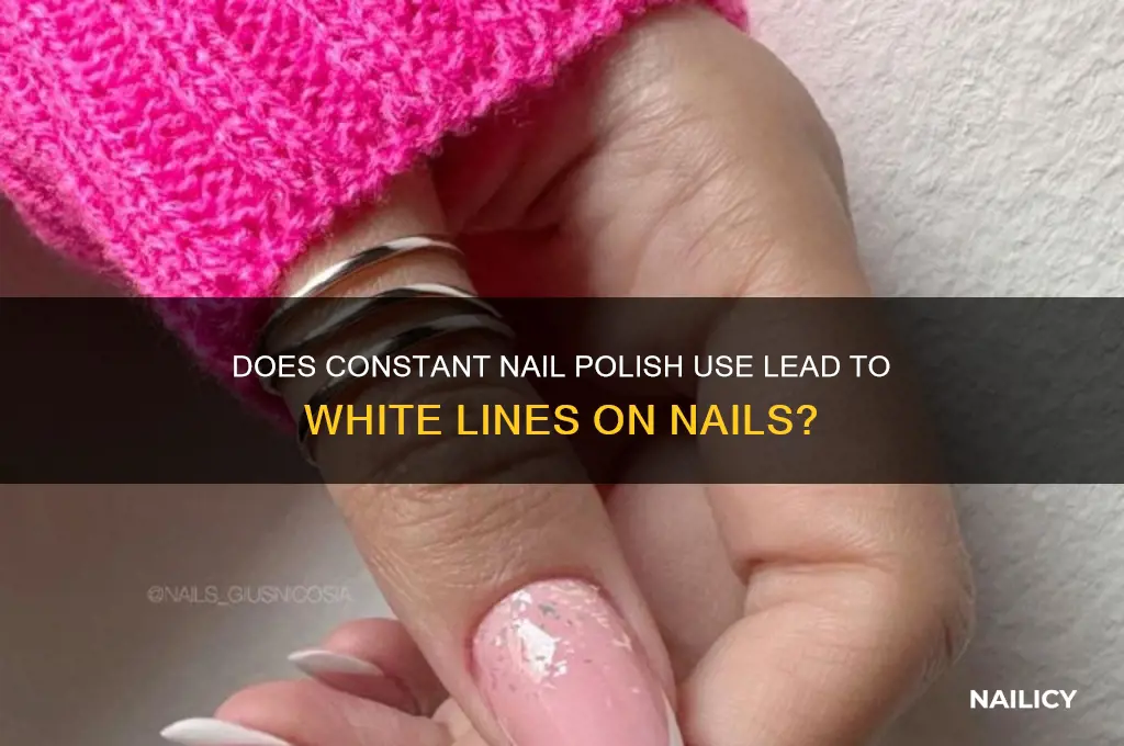 can constant nail polish cause white lines on nails
