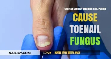 Nail Polish and Toenail Fungus: Uncovering the Hidden Risks