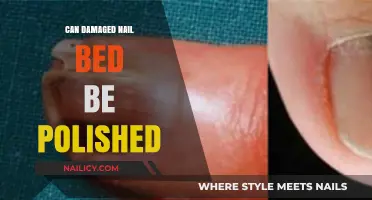 Can You Polish a Damaged Nail Bed? Expert Tips and Advice