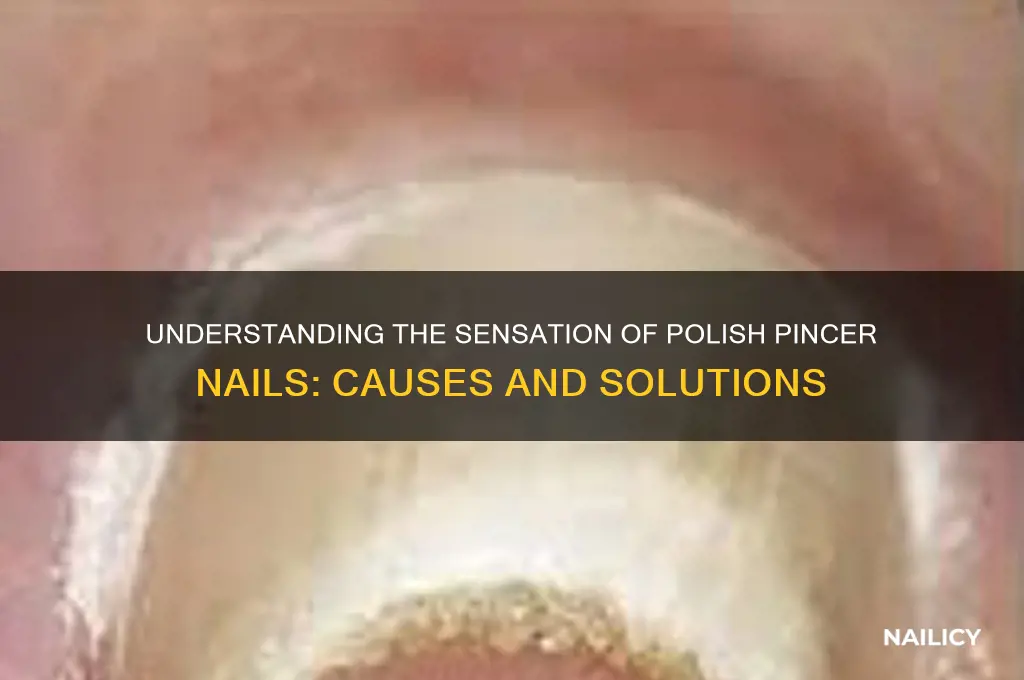 can feel polish pincer nails