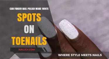 Can Nail Polish Cause White Spots on Toenails? Explained