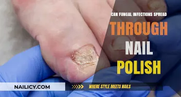 Can Fungal Infections Spread Through Nail Polish? Uncovering the Truth