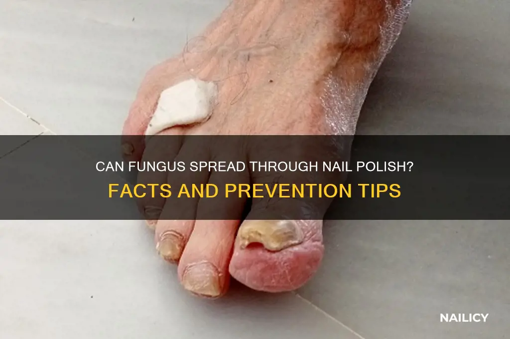can fungus transfer from nail polish