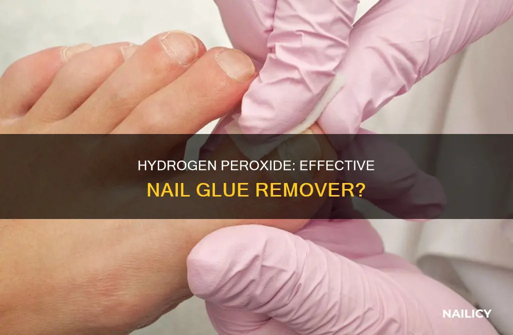 can hydrogen peroxide remove nail glue