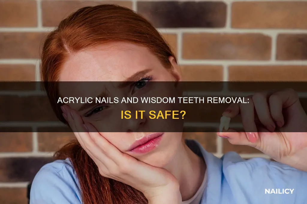 can i have acrylic nails during wisdom teeth removal