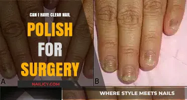 Clear Nail Polish and Surgery: What You Need to Know Beforehand