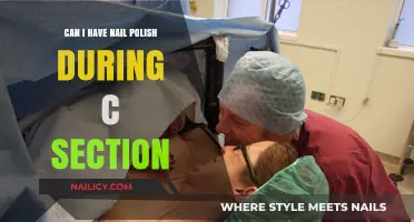 Nail Polish and C-Section: What You Need to Know