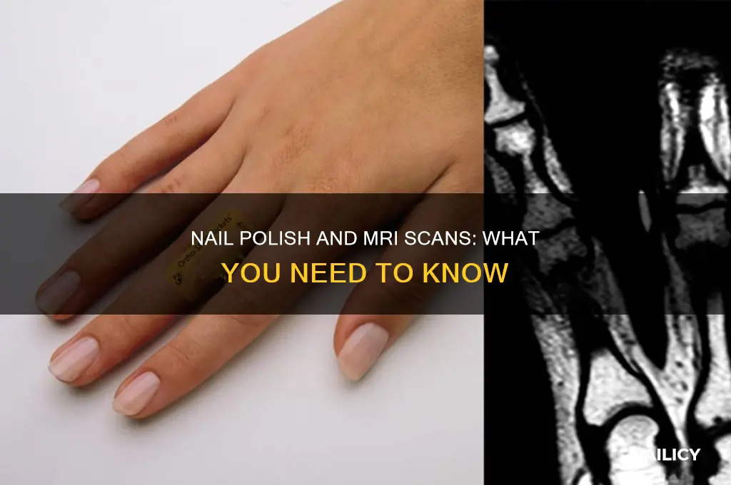 can i have nail polish during mri